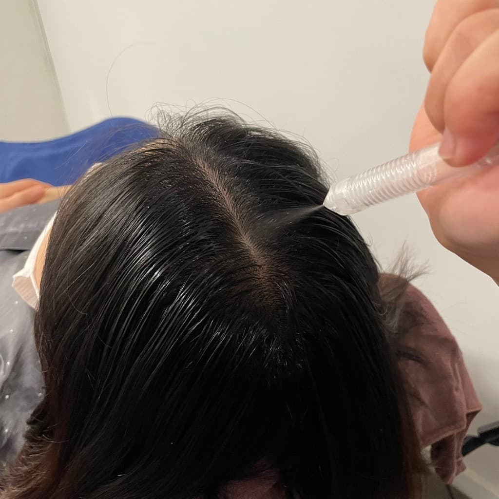 고객 두피 가르마를 따라 정밀 분사 솔루션을 적용하는 전문 관리 장면